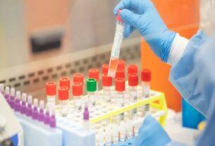 Pathology Price Wars! Huge Discrepancies in Lab Test Charges Leading to Patient Exploitation.