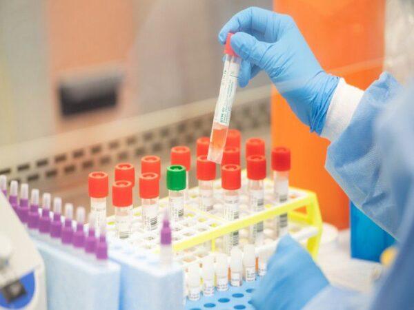 Pathology Price Wars! Huge Discrepancies in Lab Test Charges Leading to Patient Exploitation.